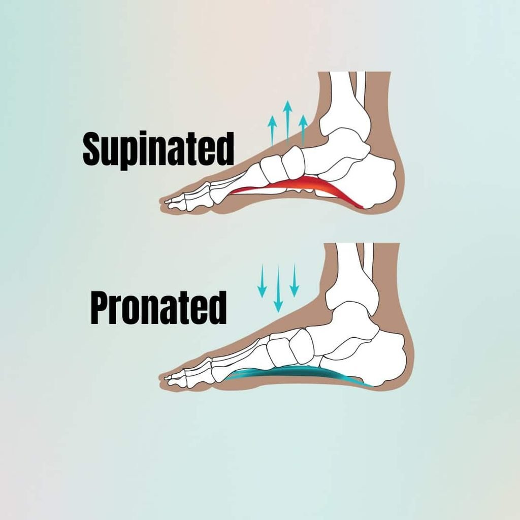 pronated feet